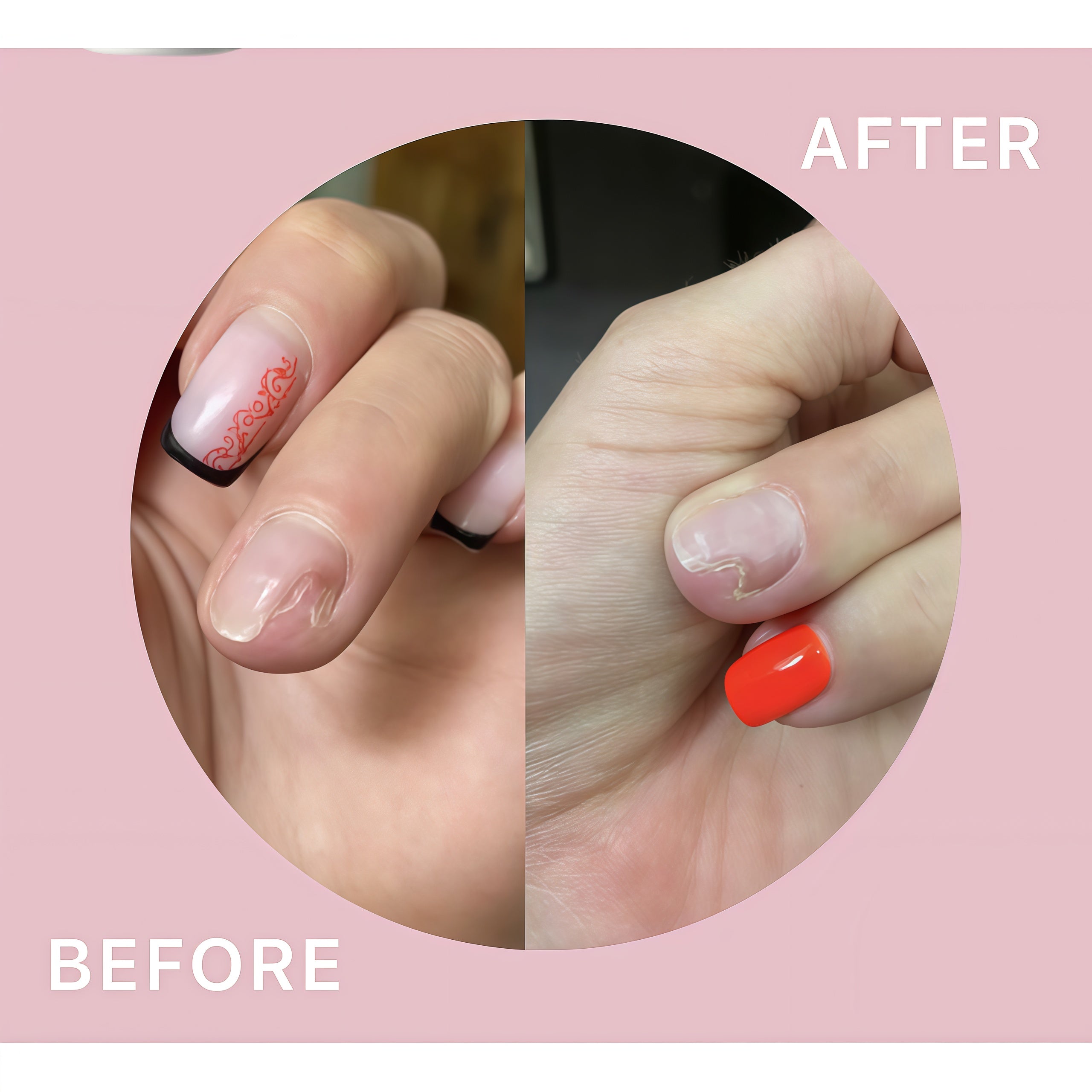 Shelly Stop Onycholysis Nail Recovery Oil with Tea Tree, Eucalyptus & Farnesol 30 ml